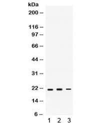 Polyclonal Rabbit anti-Human HRAS / H-Ras Antibody (WB)