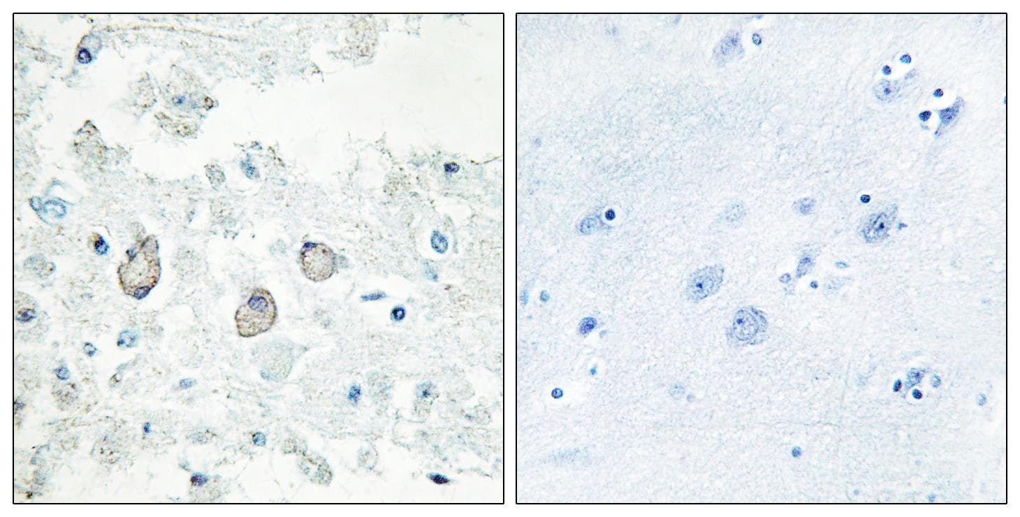 Polyclonal Rabbit anti-Human DOK7 Antibody (IHC, IF, WB)