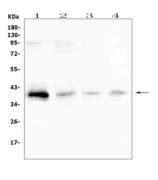 Polyclonal Rabbit anti-Human RP2 Antibody (IHC, WB)