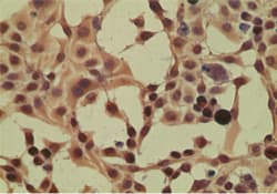 IPO8 / Importin 8 Antibody (aa850-900)