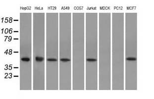 ACAT2 Antibody (clone OTI3A11, Carrier-free)