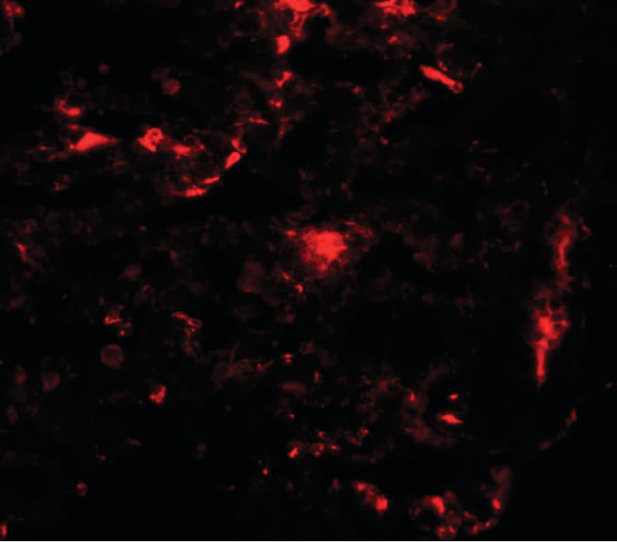 REEP2 Antibody