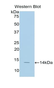 SELP / P-Selectin / CD62P Antibody (aa58-158)