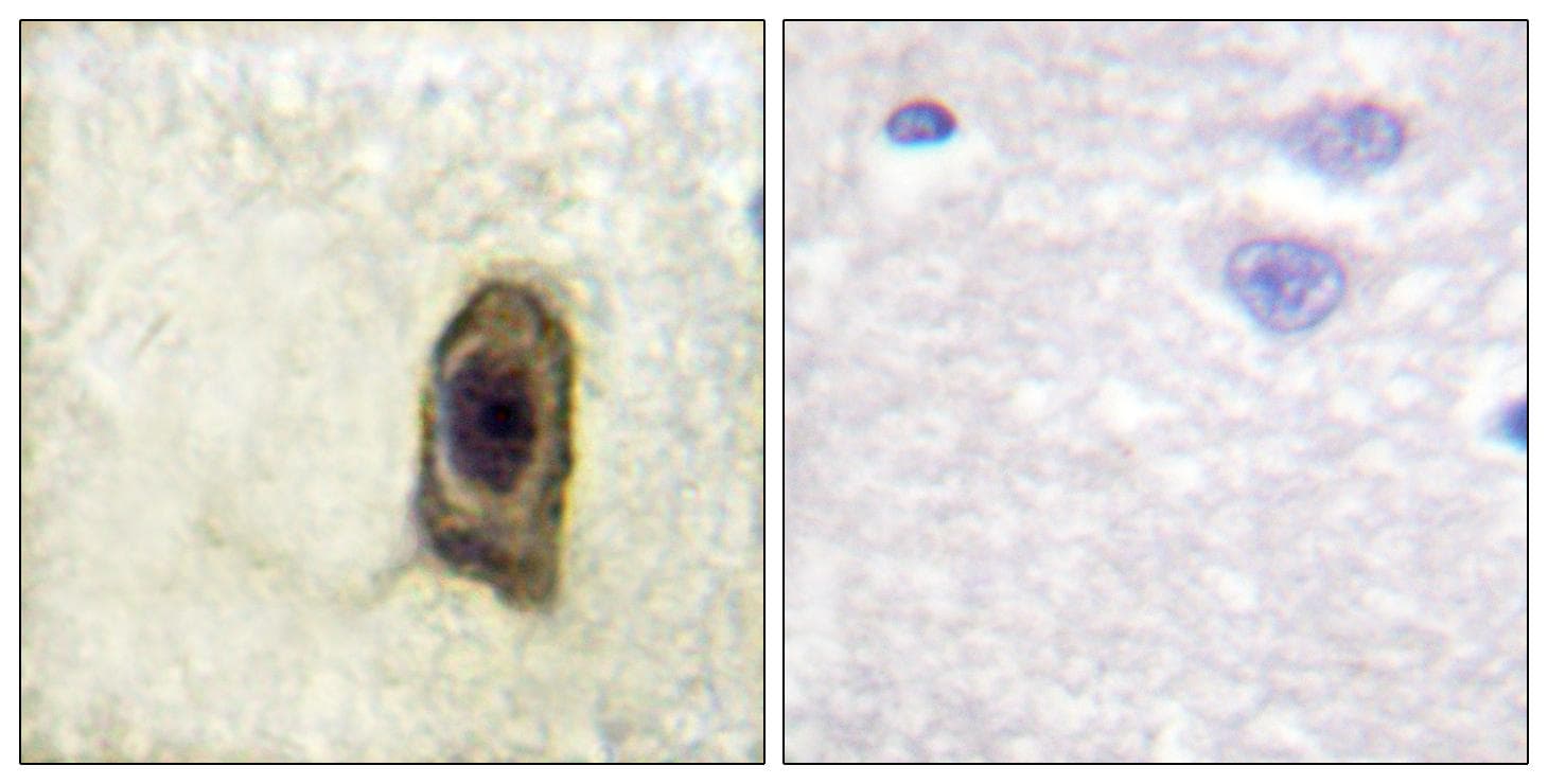 CSF1R / CD115 / FMS Antibody (phospho-Tyr561)