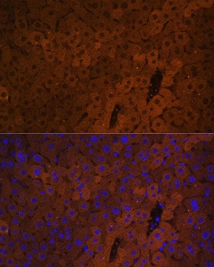 UGT1A / UGT1A1 Antibody