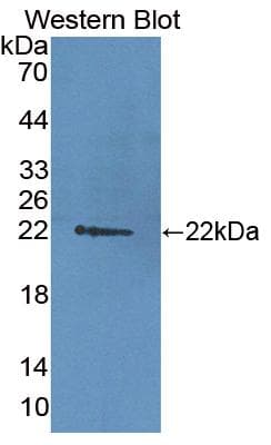 DDB2 Antibody (aa212-407, HRP)