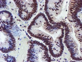 Monoclonal Mouse anti-Human RFXANK Antibody (clone OTI2B6, IHC, IF, WB)