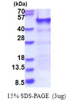 Human NELFE / RD / RDBP Protein (Recombinant His)