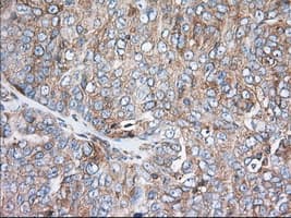 TTC32 Antibody (clone OTI1F7)