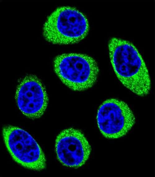 PCDH1 / PCD1 Antibody (aa179-206)