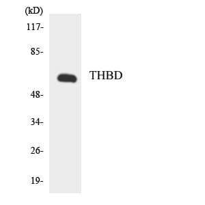 THBD / CD141 / Thrombomodulin Antibody (aa526-575)