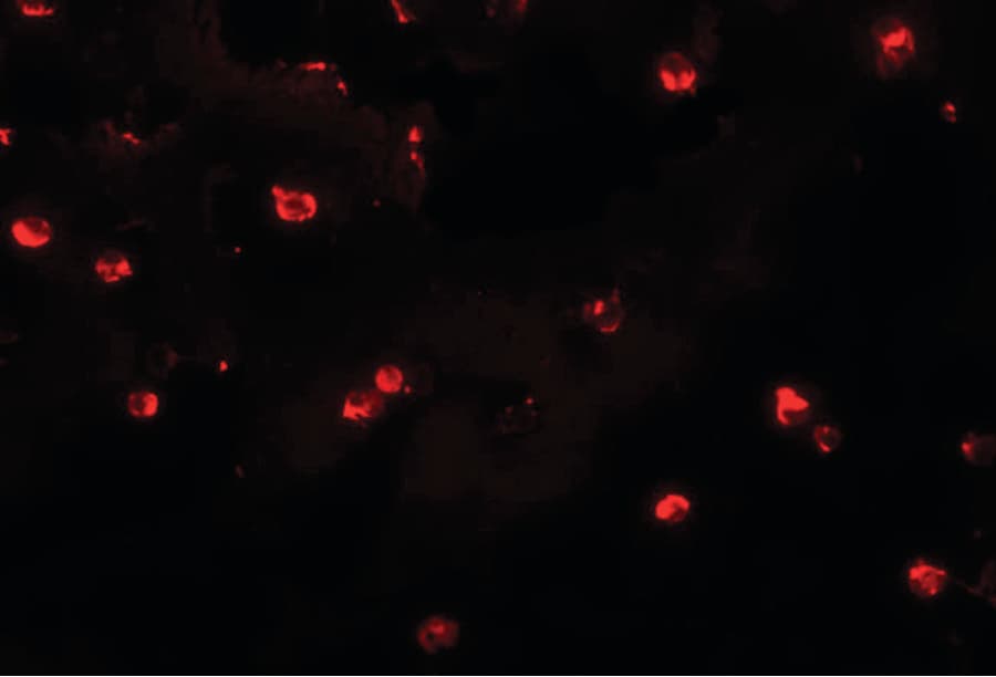 IHC-plus™ Polyclonal Chicken anti-Human KLHL25 Antibody (IHC, IF, WB)