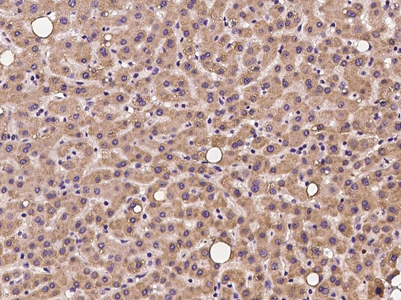 OXSM / KS Antibody