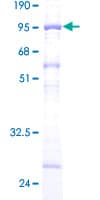 Human SKD1 / VPS4B Protein (Recombinant GST)