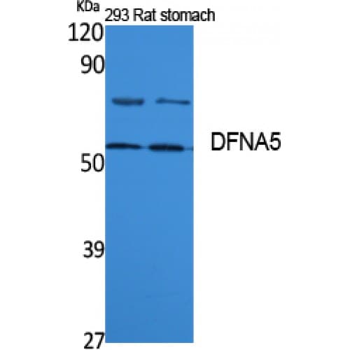 DFNA5 Antibody (200-280 aa, Internal)