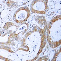 TRADD Antibody (C-Terminus)