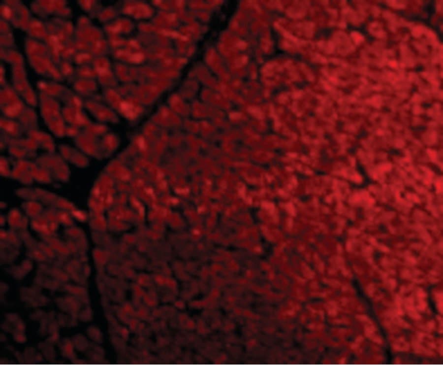 IHC-plus™ TIRAP Antibody