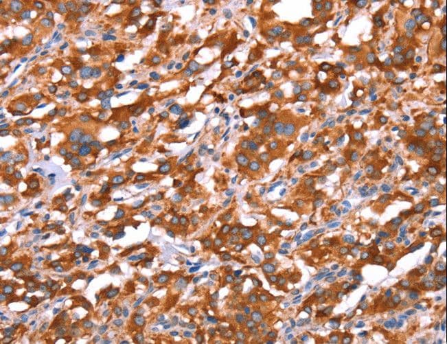 GAS8 Antibody