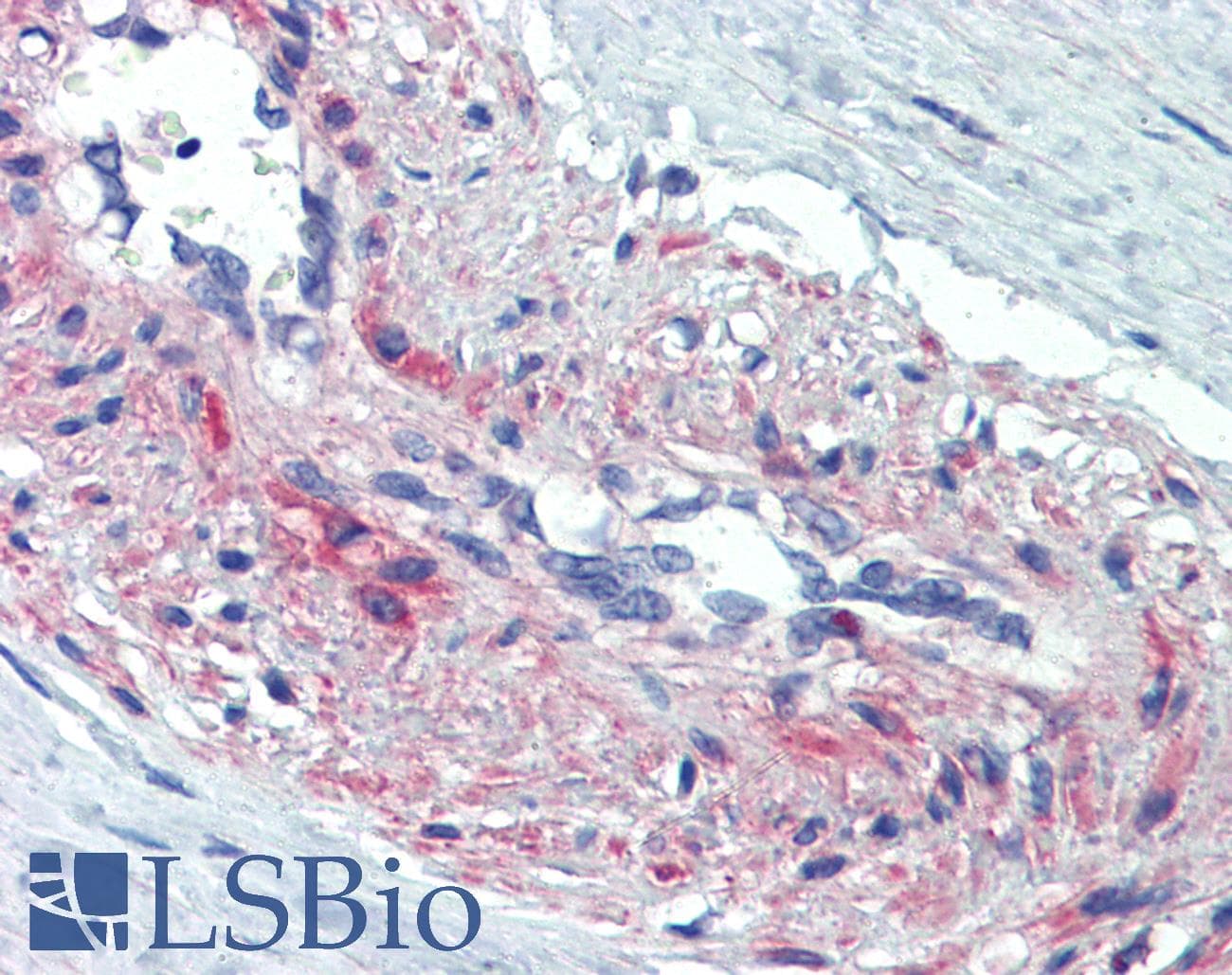 Polyclonal Rabbit anti-Human SSX4 Antibody (aa108-157, IHC, WB)