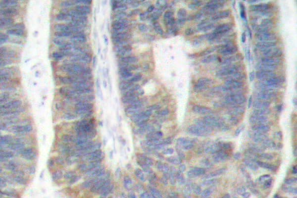 EIF2AK2 / PKR Antibody (Arg445)