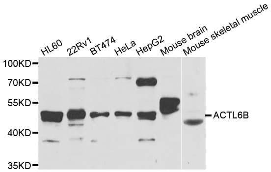 Polyclonal Rabbit anti-Human BAF53B / ACTL6B Antibody (IHC, IF, WB)