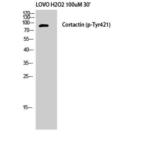 Polyclonal Rabbit anti-Human CTTN / Cortactin Antibody (360-440 aa, IHC, WB)