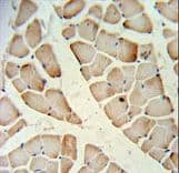 HFE2 / Hemojuvelin Antibody (aa134-162)