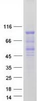 Human FOXP4 Protein (Recombinant Myc-DDK (Flag))