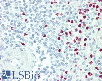 PADI4 / PAD4 Antibody (aa1-300)