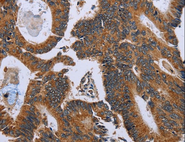 GH2 Antibody