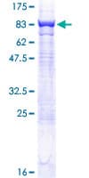 Human CES2 / Esterase Protein (Recombinant GST)