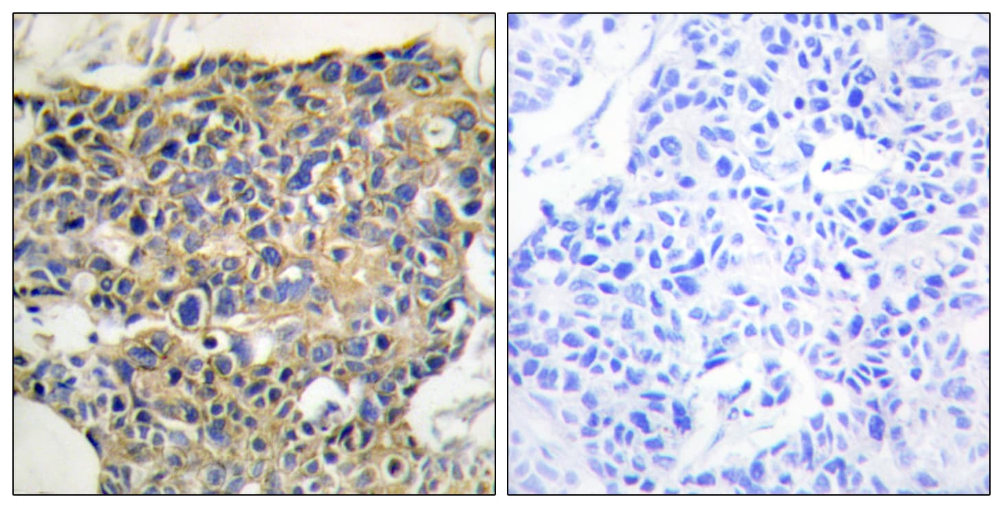 Polyclonal Rabbit anti-Human EGFR Antibody (phospho-Tyr1016, IHC, IF, WB)
