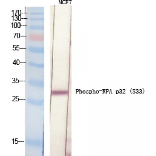 Polyclonal Rabbit anti-Human RPA2 / RFA2 / RPA34 Antibody (10-90 aa, WB)