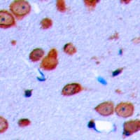 Polyclonal Rabbit anti-Human OPRD1 / Delta Opioid Receptor Antibody (phospho-Ser363, IHC, IF, WB)