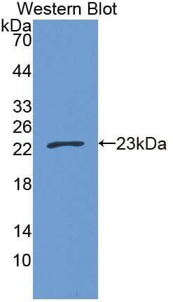 CPT1B Antibody (aa602-772)