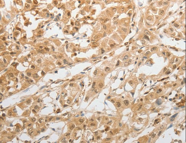 GRIN2C / NMDAR2C / NR2C Antibody