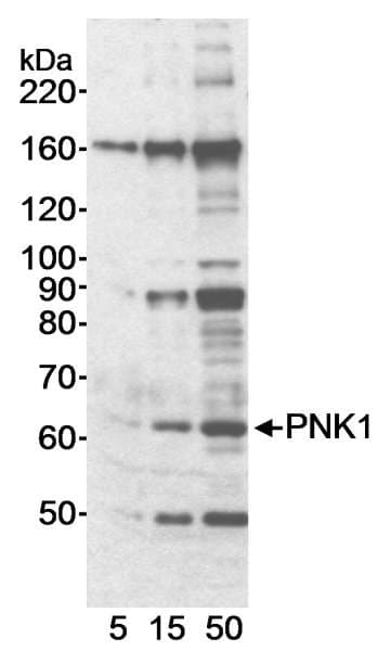 PNKP Antibody (aa100-150)