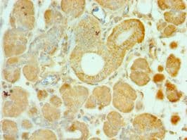 ALS2 / Alsin Antibody (aa1-280)