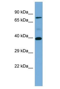 Polyclonal Rabbit anti-Human p56lck / LCK Antibody (aa21-70, WB)