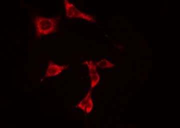 PNPLA8 Antibody