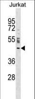 NUP43 Antibody (aa142-171)