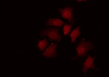 Polyclonal Rabbit anti-Human MYC / c-Myc Antibody (phospho-Ser62, IHC, IF, WB)