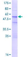 Human IGKV1-5 / Immunoglobulin kappa Protein (Recombinant GST, N-terminus)