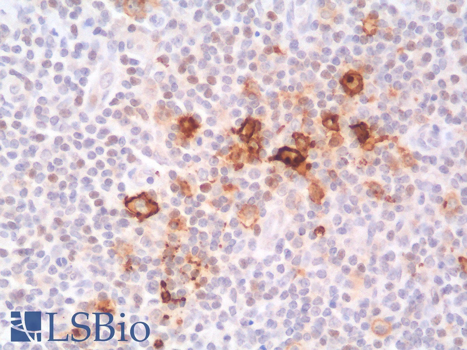 PathPlus™ Recombinant Monoclonal Mouse anti-Human CD30 Antibody (clone rKi-1/779, IHC)