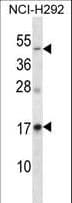 RAMP3 Antibody (aa90-118)