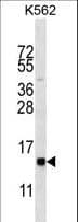 Polyclonal Rabbit anti-Human HIST1H2BL Antibody (aa1-30, WB)