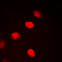 NXF / NPAS4 Antibody (C-Terminus)