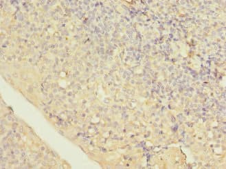 Polyclonal Rabbit anti-Human LITAF Antibody (IHC, WB)