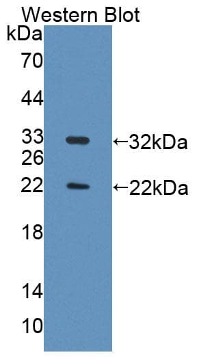 TOPBP1 Antibody