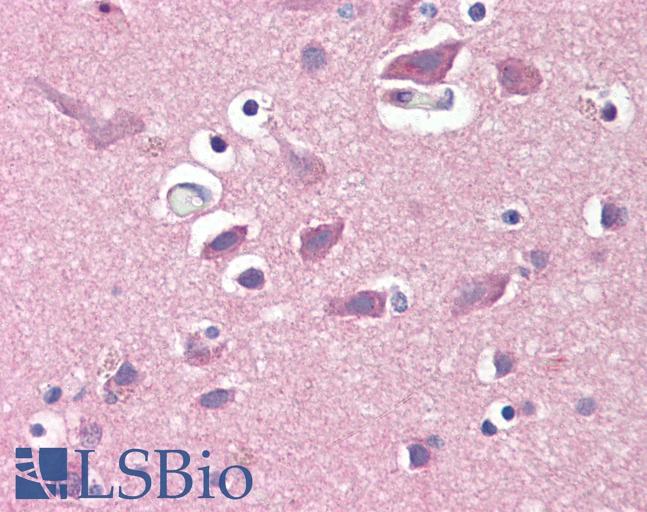 IHC-plus™ Monoclonal Mouse anti-Human GRIA2 / GLUR2 Antibody (aa175-430, IHC, WB)